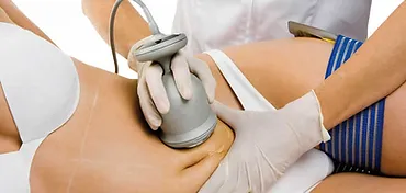 Body Sculpting/Contouring | Ultrasonic Cavitation